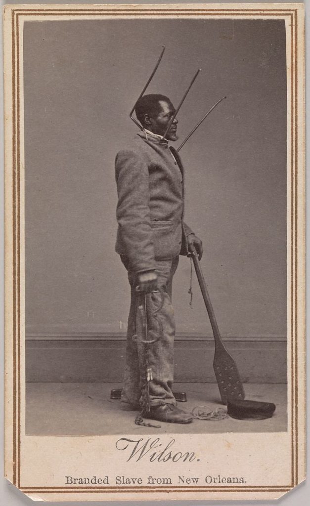 Photograph of Wilson, Branded Slave from New Orleans